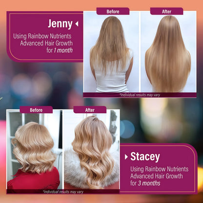 Rainbow Nutrients | Hair Growth Vitamins for Women | Biotin 10,000mcg, Collagen, Patented OptiMSM®, goMCT®, Saw Palmetto | Naturally Regrow Stronger & Healthier Hair, Skin and Nails | Stops Hair Loss | 60 Day Supply